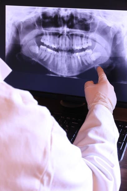 Best Emergency Dentist for Lost Fillings or Crowns in Dyersburg, TN