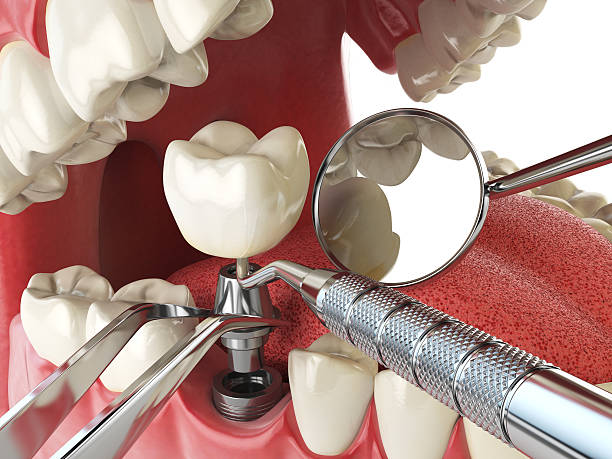 Best Broken or Cracked Tooth Emergency Dentist in Dyersburg, TN